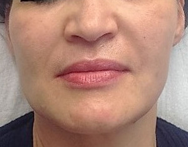 Dr. Natalie Keller - After