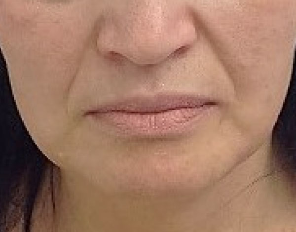 Dr. Natalie Keller - Before