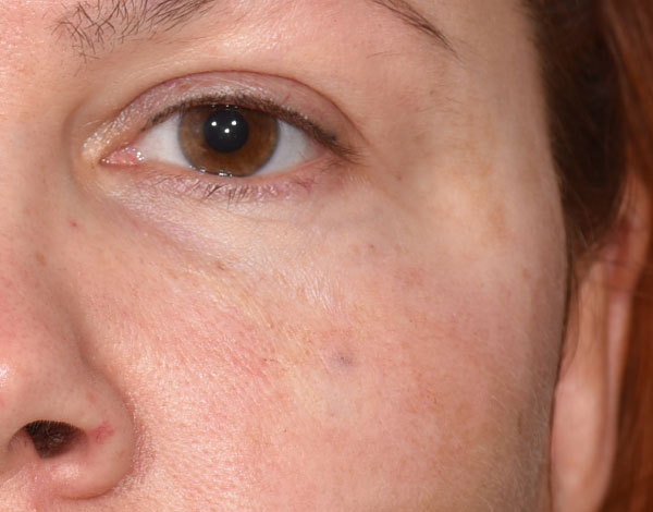 Dr. Joan VanDeputte - After