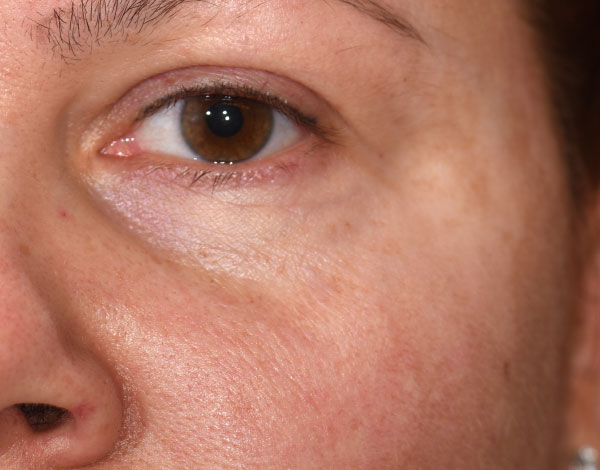 Dr. Joan VanDeputte - Before